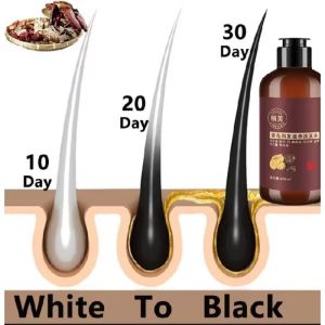 SAMPO UBAN YURIZUMI SAMPO HERBAL NATURAL  TERBUKTI  PALING AMPUH MENGHILANGKAN UBAN - 300ml