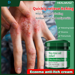 COD Itchy cream Ointment anti itch cream for skin Treatment Cream for Itchy Skin and Allergy Herbal CreamRepel mosquitoes and relieve itching