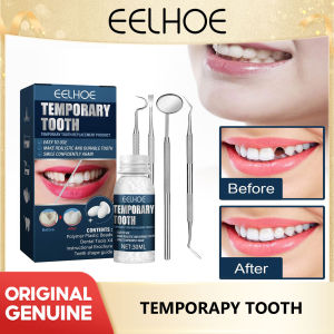 Eelhoe Dental Filling Set With Plastic Modified Dental Glue For Temporary Filling Of Missing And Broken Teeth Repairing Cavities And Filling Gaps Between Teeth Temporary Tooth Repair Kit Glue Denture Adhesive Set