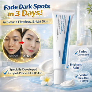Spot Removal Cream Whitening Freckle Cream Dark Spots Brighten Skin Pekas Eraser Cream Moisturizing Brighten Improving Uneven Skin Tone