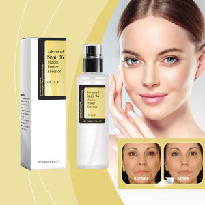 OUHOE Essence 100ML /Cosrx Advanced Snail 96 Mucin Power Essence /Snail mucin essence /Anti-Aging Facial Serum