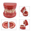 3D Resin Dental Model Teeth Malocclusion Model For Demostration Teaching Dental Students Study Oral Dentistry Products. 