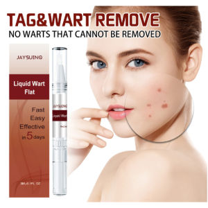 Penghilang Kutil & Tahi Lalat: Solusi Ampuh untuk Kulit Sensitif