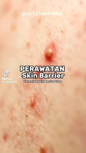 BARUUU !!!! Ceramide Skin Barrier Care SR12 7x Ceramide Pelembab Kulit Yg bikin Glowing