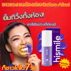 ลองยาสีฟันสีม่วง! ฟันขาวใน 7 วัน เซรั่มฟันขาว ยาสีฟัน ยาสีฟันฟันขาว ยาสีฟันขาว Teeth whitening ยิ้มมั่นใจทุกวัน ด้วยฟันขาวสะอาดลดคราบเหลืองช่วยให้ฟันขาวกระจ่างอย่างเป็นธรรมชาติปลอดภัยไม่ทำให้เสียวฟัน