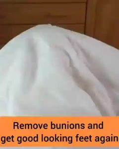 Yufa 2 Pairs Bunion Corrector Sock - 2023 New Orthoes Bunion Relief Socks Women ＆ Men Comfortable Orthopedic Bunion Toe Corrector Big Toe Straightener ce Hallux Valgus Corrector Bunion Pads (Beige)