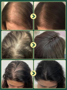 Shampoo Hair Wash Oil Control For Summer Women/Moisturizing Smoothing/Refreshing Scalp Care/Oily Scalp Adult Rosemary Clean/Anti-Grease