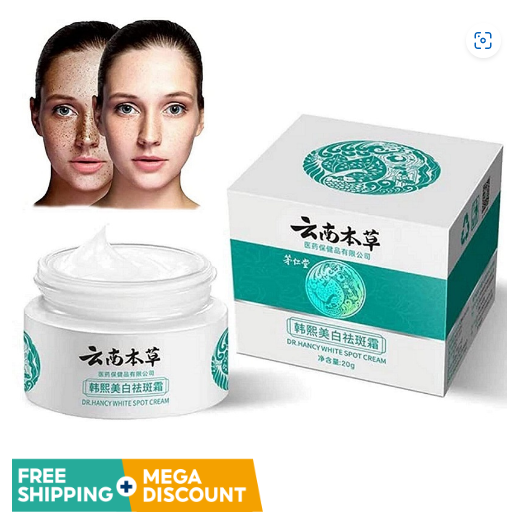 Freckle Cream Dark Spots Remover Melasma Cream Fade Dark Spots ...