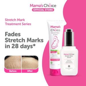 Mamas Choice Pregnancy Stretch Mark Treatment Set | Cream & Serum | Helps Fade Stretch Marks