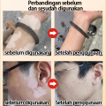 1 hari sembuh KADAI Salep Vitiligo 100% menghilangkan Menghambat Pertumbuhan Kulit Putih mengaktifkan melanin Meratakan Warna Kulit Untuk tubuh dan wajah formula jamu Tidak melukai kulit(vitiligo cream obat salep vitiligo vitiligo obat). 