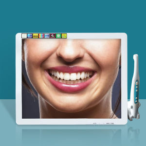 Dental Endoscope All-in-one Oral Hd Camera Oral Instrument Material Dentist Teeth Tool