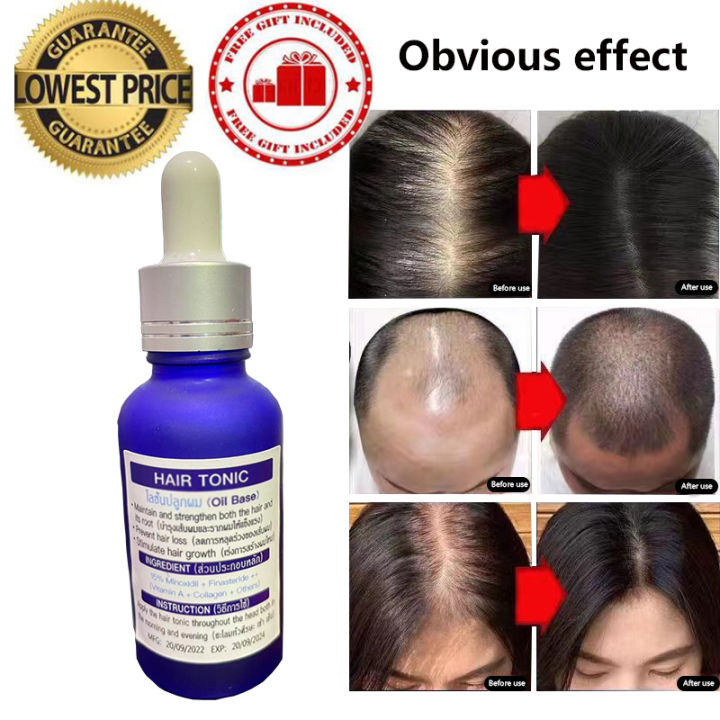 15% Minoxidil HAIR TONIC (Oil based) Hair Grower beard Grower ...