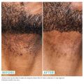 Daily Mens Exfoliating Face Wash   Scrub | Urban Skin Rx® | Powerful 2-in-1 Cleanser and Scrub | Cleans Pores of Dirt and Oil. Formulated with Salicylic Acid, Jojoba Beads and Niacinamide | 5.1 fl oz. 