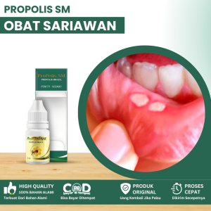 Obat Sariawan Obat Sariawan Parah Radang Sariawan Obat Sariawan Menahun Obat Sariawan Berdarah Obat Sariawan Di Lidah Perih Dan Sakit Dengan Propolis SM