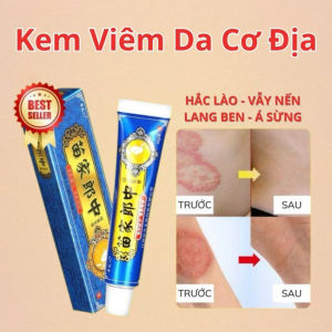 Kem xanh bôi nấm hắc lào Vỏ Nhôm 15g