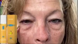 [Moisturizing Eye Serum Oil]— Hydrate Reduce Fine Lines Gentle Nourish for Under-Eye Anti-Aging Eye Care!