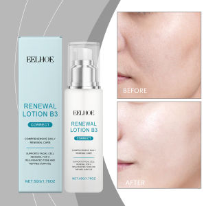 EELHOE Renewal Lotion Moisturizing hydrating smooth and delicate increasing skin elasticity gentle facial care Renewal Lotion;Renew Lotion;Renewal Facial Lotion