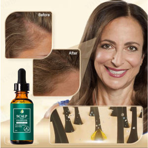 [Repair Folliculitis/Remove Mites/Hair Growth] Hair Root Repair Essential Oil AntiItch Hair Loss Prevention Hair Care Oil Herbal Extracts Healthy Safe Effective Hair Growth 30ml