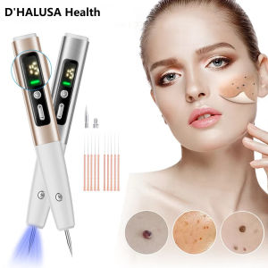 Skin Tag Remover ไฟฟ้า Skin Tag Removal Dark Spot Mole Remover ปากกากระหูด Tattoo Nevus จุดด่างดําเลเซอร์พลาสม่าปากกา