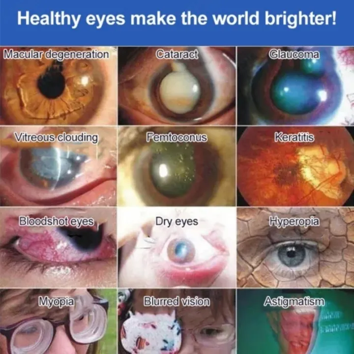 Japan%20Astigmatism%20Short-Sighted%20Eye%20Drops%20Dry%20Eye%20Relief%20Cure%20Sore%20Eyes%20And%20Blurred%20Vision%20Ubat%20Mata%20Rabun%20Ubat%20Mata%20Selaput%20Penawar%20Mata%20Eye%20Care%20Original%20%E7%9C%BC%E8%8D%AF%E6%B0%B4%20-%20Image%208
