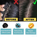 Anti dandruff shampoo，anti-itch shampoo，oil control shampoo 300ml Makes hair fresh, smooth, clean, sterilizes, and deeply cleans the scalp. It can be used by men, women, the elderly, and children.. 