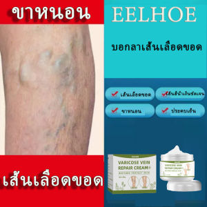 EELHOE เส้นเลือดขอด รักษาเส้นเลือดขอด ครีมทาเส้นเลือดขอด แมงมุมเส้นเลือดปวด ฟื้นบำรุงผิวที่สมบูรณ์แบบ รักษาขาให้สวย บรรเทาเส้นเลือดขอด Varicose Vein Cream【50g】