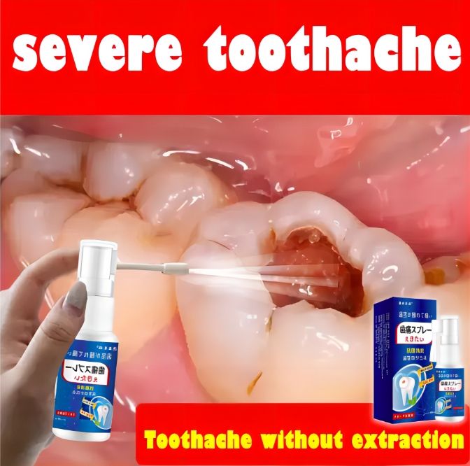 Toothache Spray Fast Pain Relief for adults and kids Periodontitis Tooth Decay Pains 20ml