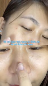 AESTURA A-CICA365 Blemish Relief Serum 40ml