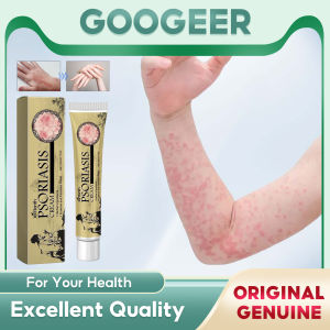 Ximonth Psoriasis Ointment Antibacterial Anti Itchy Eliminate Dermatitis Improve Rash Desquamation Urticaria Treatment Cream Quickly Relieve Ilching Effectively Alleviate Cowhide Moss Or Other Skin Problems(20g)