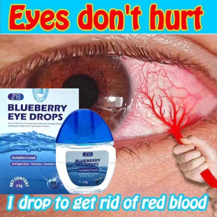 Blueberry Eye Drops Itchy Relieves Dry Eyes Sore Red Eyes Discomfort ...