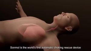 One-Press Anti-Choking Suction Rescue Device for s Kids Infants Portable Asphyxia Rescue Machin