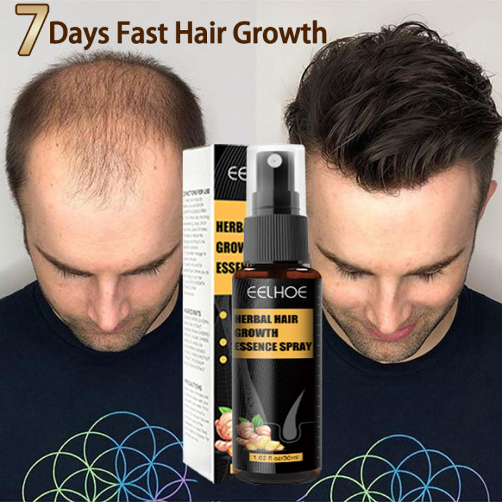 🔥7 Days Fast Hair Growth 🔥c C Outlet Hair Grower For Men Original