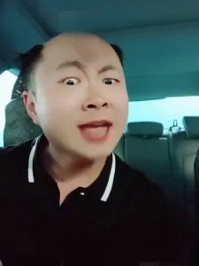 【Ship in 24H】男士补发片假发套头顶补发前额秃顶补发垫接发翻盖假发真发男发块Mens replacement wig cover top of head replacement forehead baldness20260721