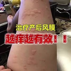【富贵手 Skinist 新肤液】✅KKM APPROVED✅ 皮肤干燥 富贵手 牛皮藓 皮肤湿疹 关节性皮炎 脚气 风膜 让你不再所困扰!!