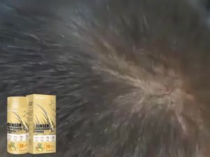 West & Month Ginger Density Baking Powder Hair Root Care Moisturizing Thick Hair Strong and Tough Anti-Drop and Solid Hair Density Baking Powder