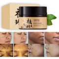 【100% Authentic】Original Melasma Cream Pekas Remover Collagen Japan Pekas Remover  Pekas & Freckles Remover Cream. 