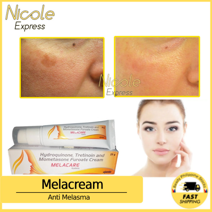 Melacare Cream 25g for Melasma Pekas Remover Pekas Eraser Skin