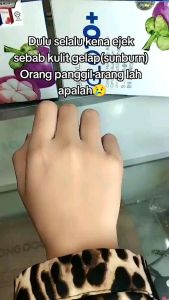 Beauxlim Glo10+ for Brightening Glowing Skin Mangosteen + Astaxanthin 15s Beauxlim Glo10 - Lazada