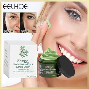 EELHOE Krim Pemutih Penghilang Noda yang Ampuh Mencerahkan Kulit dengan Cepat Menghilangkan Pigmentasi Melanin Melasma Flek Hitam Melembabkan Bintik-bintik Krim Pemutih