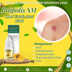 Propolis Sm - Obat Bisul Bisul Bernanah Penghilang Bisul Obat Tetes Bisul Bisul Di Badan