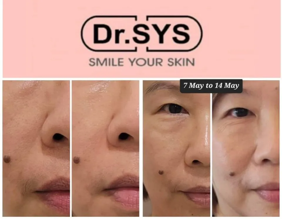 DR.SYS PS Stem Cell Ampoule - Lazada | Lazada