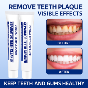 Dental Specialty Teeth Separation Toothpaste For Gum Health Efficient Cleaning Oral Care Periodontal Care Teeth Repair Toothpaste For Sensitive Teeth And Gum Swelling Professional Dental Care Solution