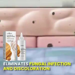 EELHOE Gel Perawatan Kutikula Instan Perbaikan Onikomikosis Kuku Lunak Kuku Busuk Kulit Mati Solusi Perawatan Melembapkan