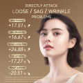 ANLAN Multifunctional Skin Care Beauty Device Collection Edition Multi-polar RF EMS Face Massager Hot Cold Compress LED Light Therapy Face Lifting Diamond Series PRO. 
