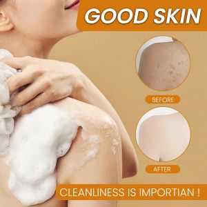 Ginger Pellet Soap Handmade Soap Lemon Ginger Cleansing Soap Soap Tartaric Acid Bath/Ginger Pellet Soap Handmade Soap Lemon Ginger Cleansing Soap Soap Tartaric Acid Bath