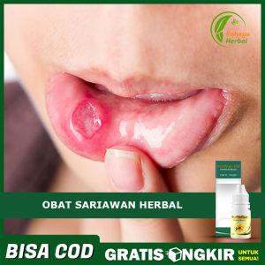 Obat Sariawan Bibir Luka Perih dan Lecet Obat Menghilangkan Sariawan Panas Dalam Obat Bau Mulut Dengan ProPolis SM Brazilian Herbal 100% Original