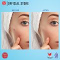Viva Acne Gel Triple Action 15 gr. 