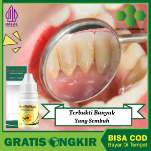 Obat Gigi Medan Obat Cabut Gigi Sendiri Pemutih Gigi Dan Perontok Karang Perontok Tunggul Gigi Hancurkan Gigi Berlubang Penghasur Sisah Gigi
