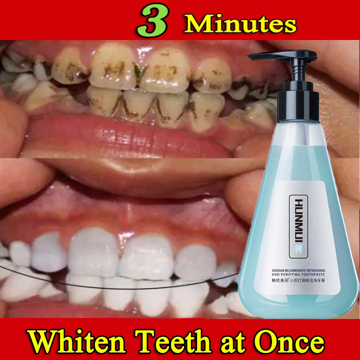 [ FREE SHIPPING FEE ] { NO.1 WHITENING TEETH } Genuine Hunmui ...