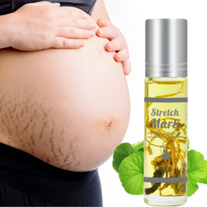 Feminine Remove Stretch Mark Oil - Essential Oil Blend for Smooth Nourished Skin